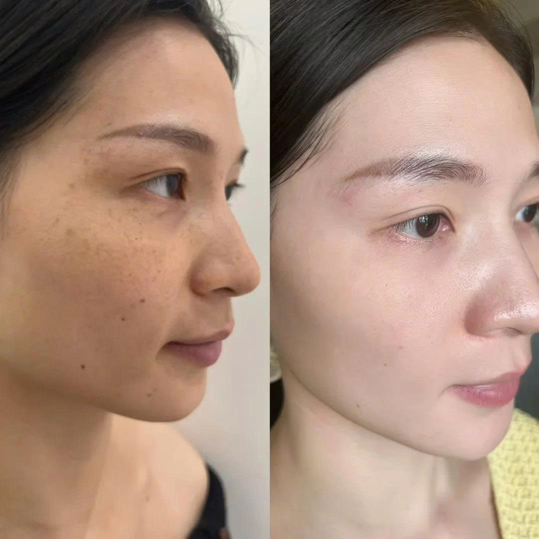顧客使用前後對照 / Ảnh trước – sau của khách