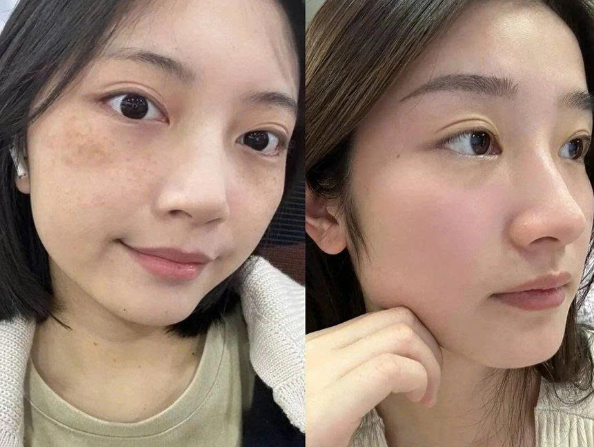 顧客使用前後對照 / Ảnh trước – sau của khách